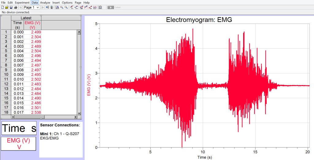 EMG Data