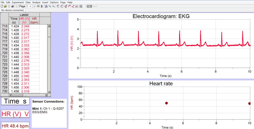Sample EKG Data